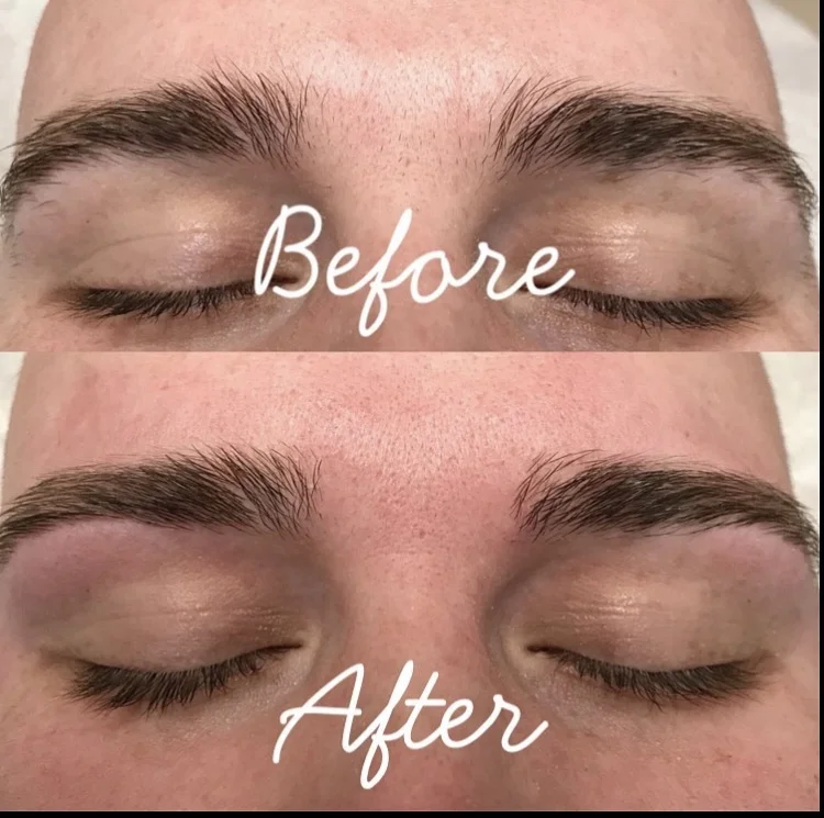 Treatment details
