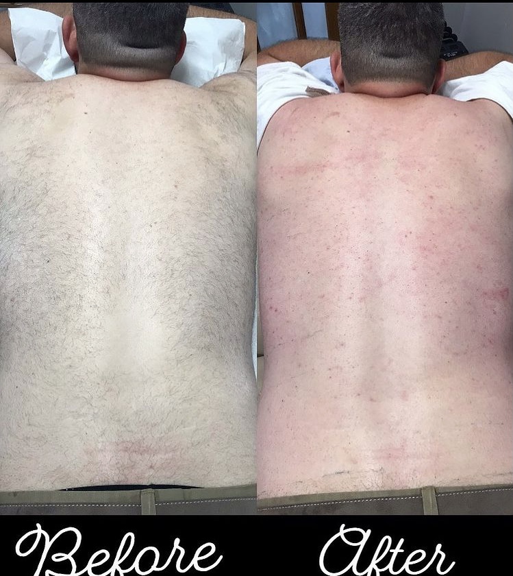 Before and after — full back waxing